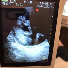 Great Grandbaby due Jan 2018 Kyleigh Nelson's  Baby