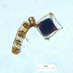 Thecate dinoflagellate feasting on diatom chain in the Bering Sea BEST cruise 2008