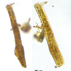 Gymnofinium dinoflagellate feasting on diatom chain in the Bering Sea BEST cruise 2008