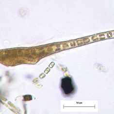 Gymnodiniod dinoflagellate with ingested diatom chain in the Oregon upwelling system
