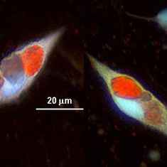 Epifluorescence photo of heterotrophic dinoflagellates with ingested picoplankton algae (red color))