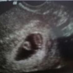 Our first sonogram