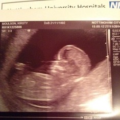 you 1st great grandchild waiting to be born .xx