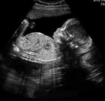 Everlynn Grace Perron
