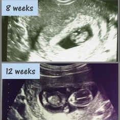 Ultrasound photos of our beautiful Gabriel at age 8 weeks and 12 weeks.