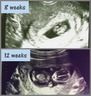 Ultrasound photos of our beautiful Gabriel at age 8 weeks and 12 weeks.