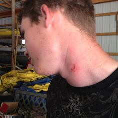 Paintball shot to the neck at Landing Zone. Wasn't me.