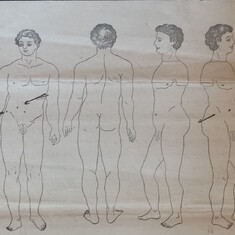 Sketch from a physical exam in 1877 for Veterans Pension