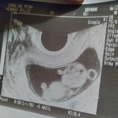 Jay's 1st ultra sound picture, he has his angel wings & halo showing.