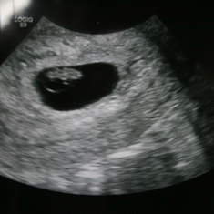 Ultrasound at 8 weeks. First time I saw my little peanut!