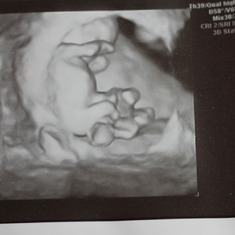 Kaden is shy like his mommy! How cool to see him in 3d at 11 weeks.