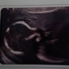 5 month Ultrasound when we found out he was a boy! 