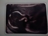 5 month Ultrasound when we found out he was a boy! 