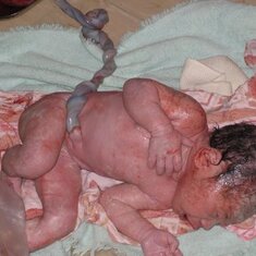 Mikah Right after birth..