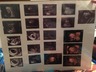 Here is all of Sophia's sonogram pictures. We miss our little girl so much. She made us a family and forever we will be together.