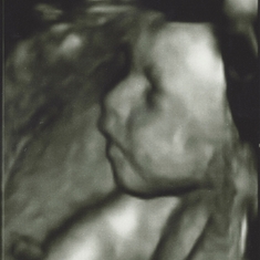 October 17th  Look like she hears us and is thinking, what's going on out there.  This is my favorite ultrasound photo.  She was alive and curious and could hear us <3