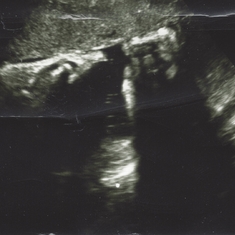Last Ultrasound Photos - I have no clue what this is?