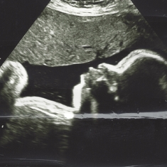 Last Ultrasound photos