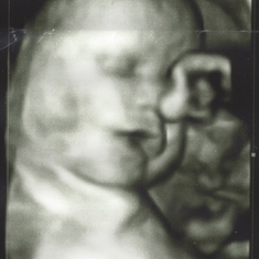 Last Ultrasound photos