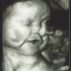 1205 Found these final ultrasound pictures from a few days before she died :(
